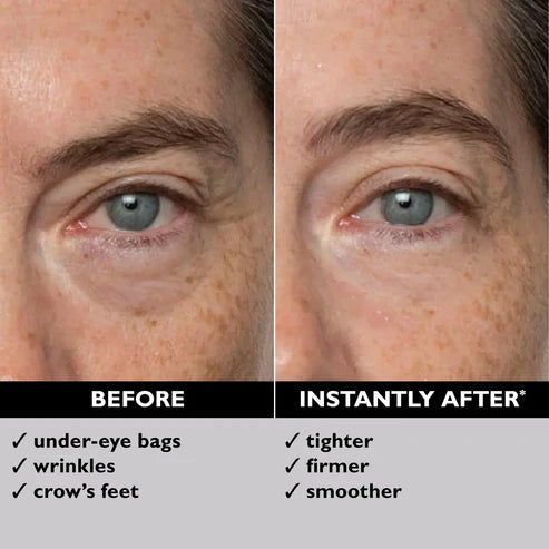 Ellavie™ Eye Bag Eraser