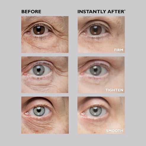 Ellavie™ Eye Bag Eraser